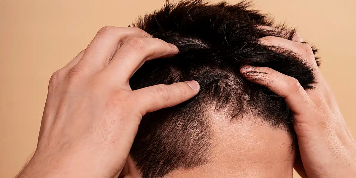 Seborea - seboroická dermatitída