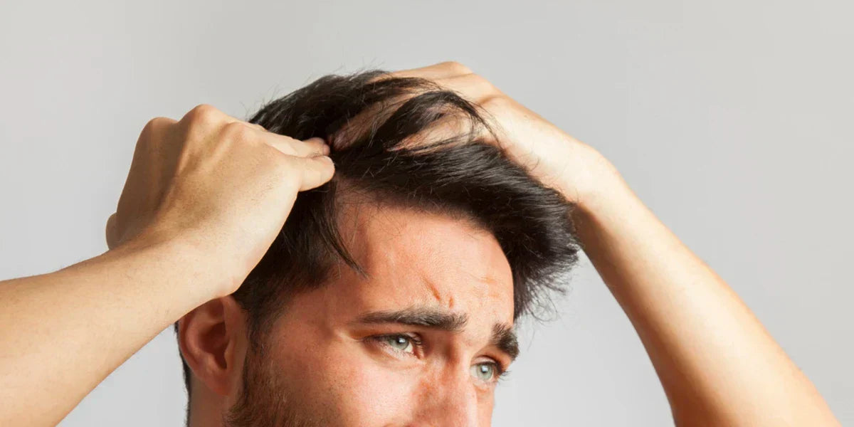 Vypadávanie vlasov u mužov
