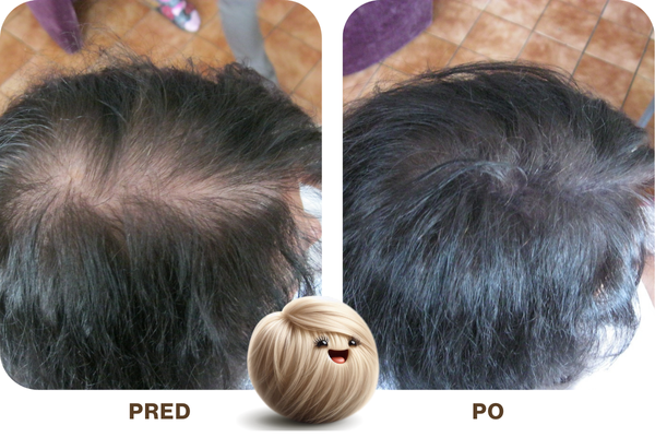 Zahusťujúce vlasové vlákna pre riedke vlasy mioWell 12g