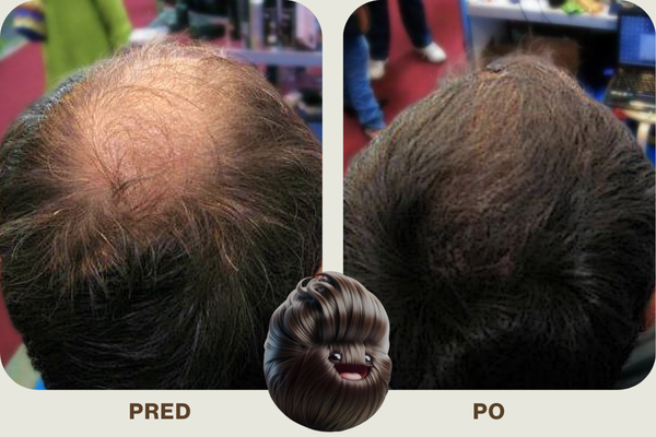 Zahusťujúce vlasové vlákna pre riedke vlasy mioWell 12g